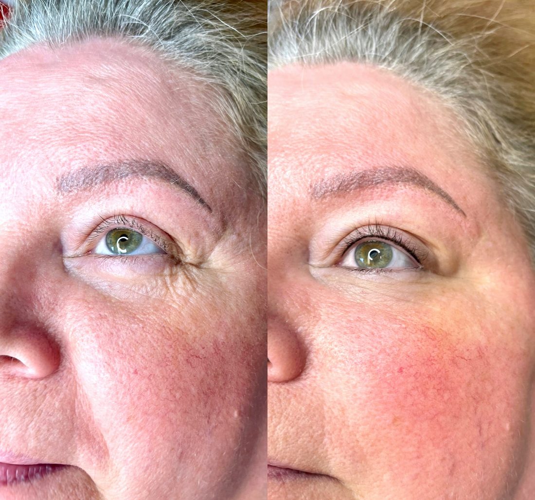 Permanent eyeliner before and after